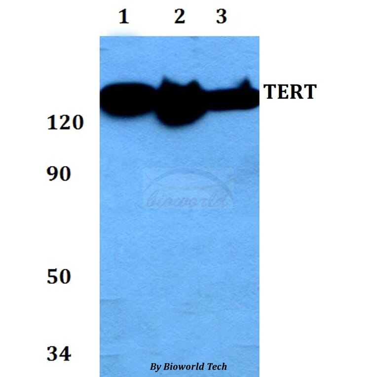 Anti-TERT (I820) Antibody from Bioworld Technology (AP0468) - Antibodies.com