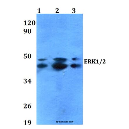 Anti-ERK1/2 (T202/Y204) Antibody from Bioworld Technology (AP0485) - Antibodies.com