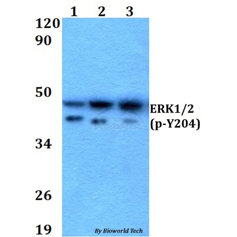 Anti-ERK1/2 (phospho-Y204) Antibody from Bioworld Technology (AP0490) - Antibodies.com