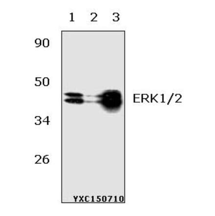 Anti-ERK1/2 (Y204) Antibody from Bioworld Technology (AP0491) - Antibodies.com
