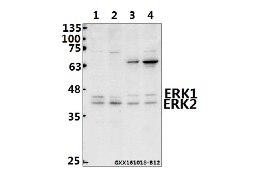 Anti-ERK1/2 (Y204) Antibody from Bioworld Technology (AP0491) - Antibodies.com