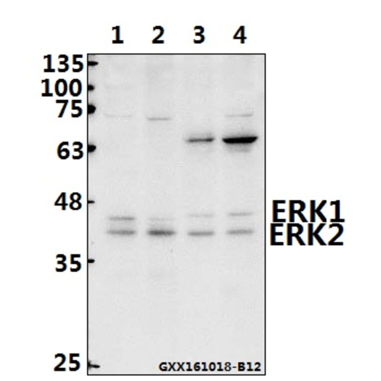 Anti-ERK1/2 (Y204) Antibody from Bioworld Technology (AP0491) - Antibodies.com