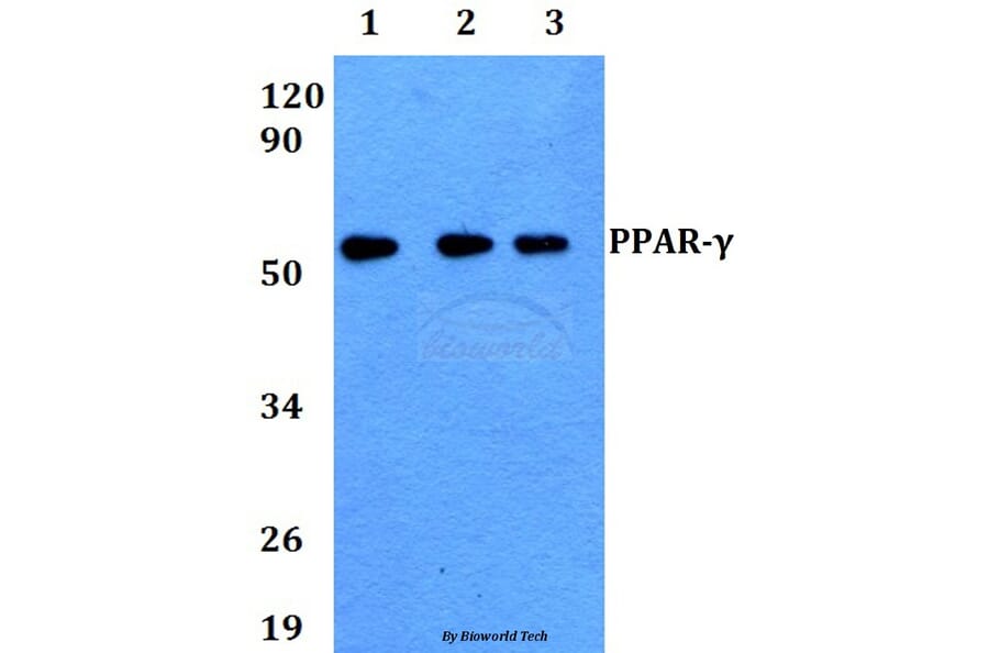 Anti-PPAR-γ (K160) Antibody from Bioworld Technology (AP0686) - Antibodies.com