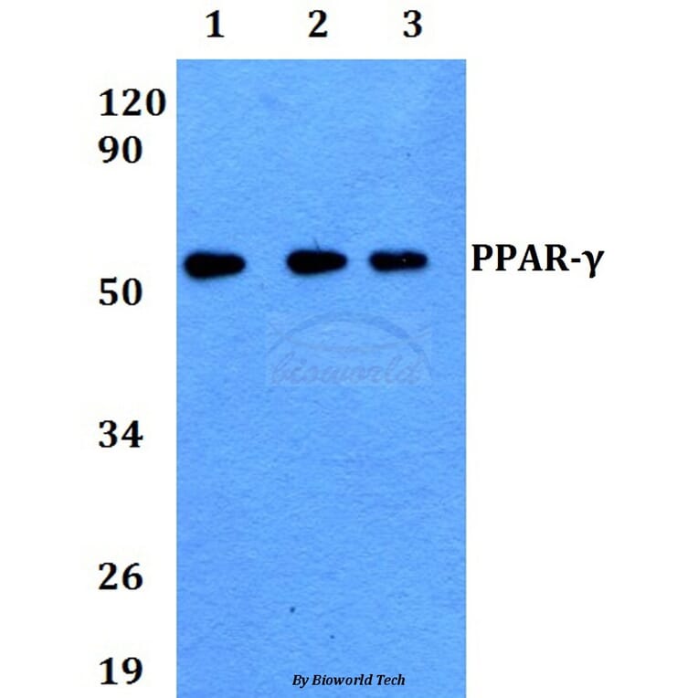 Anti-PPAR-γ (K160) Antibody from Bioworld Technology (AP0686) - Antibodies.com