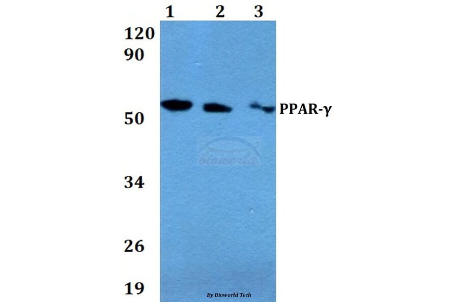 Anti-PPAR-γ (E157) Antibody from Bioworld Technology (AP0688) - Antibodies.com