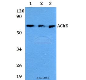 Anti-AChE Antibody from Bioworld Technology (AP0691) - Antibodies.com