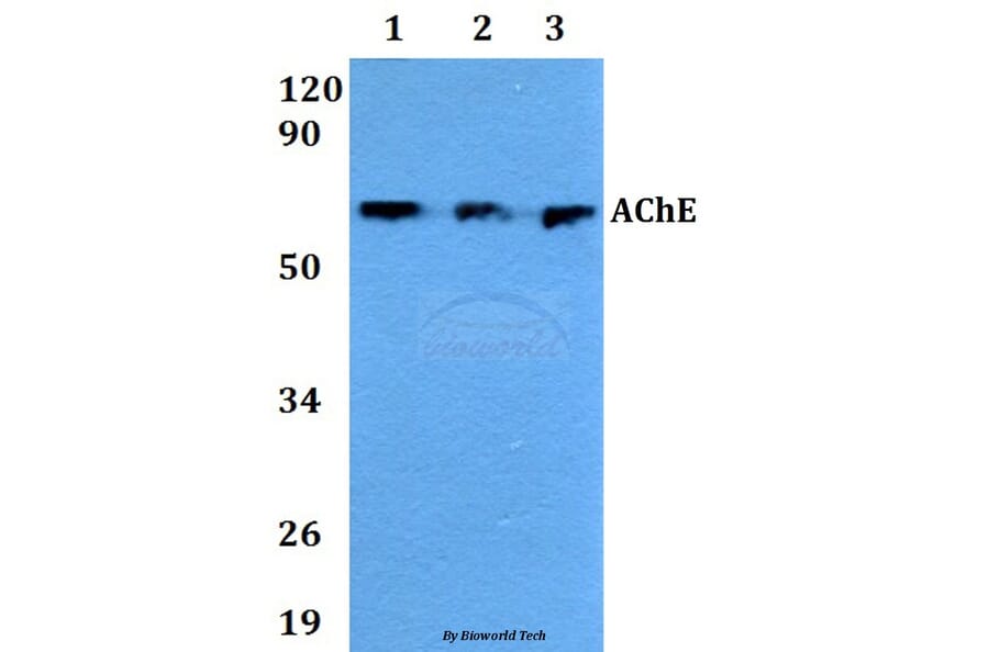 Anti-AChE Antibody from Bioworld Technology (AP0691) - Antibodies.com