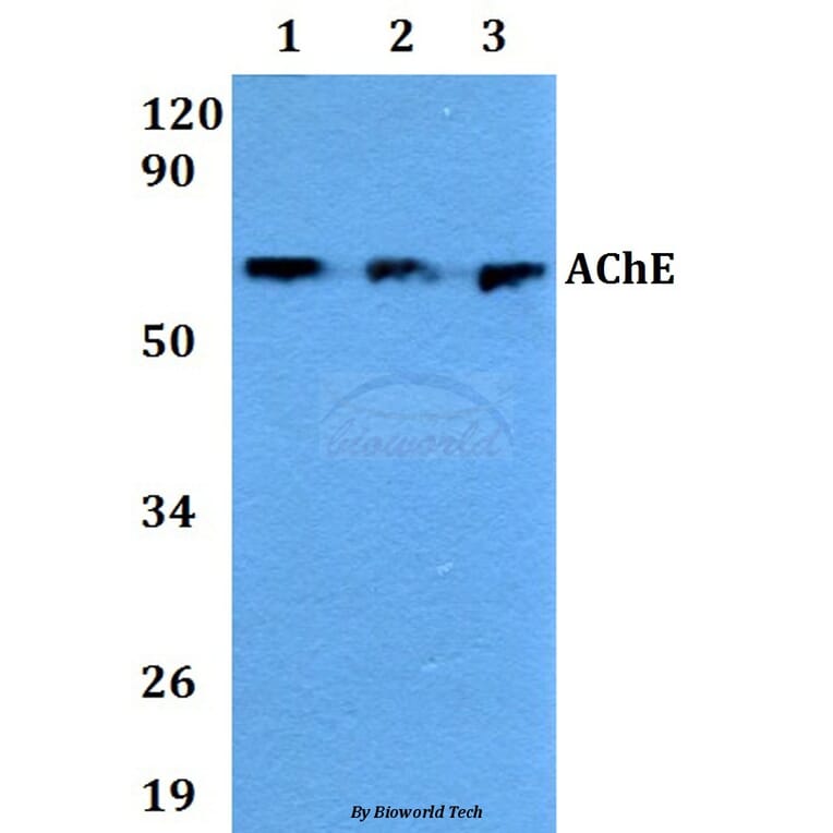 Anti-AChE Antibody from Bioworld Technology (AP0691) - Antibodies.com