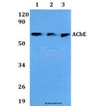 Anti-AChE Antibody from Bioworld Technology (AP0691) - Antibodies.com