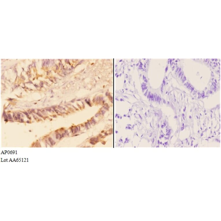 Anti-AChE Antibody from Bioworld Technology (AP0691) - Antibodies.com