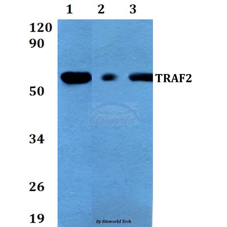 Anti-TRAF2 (S11) Antibody from Bioworld Technology (AP0694) - Antibodies.com
