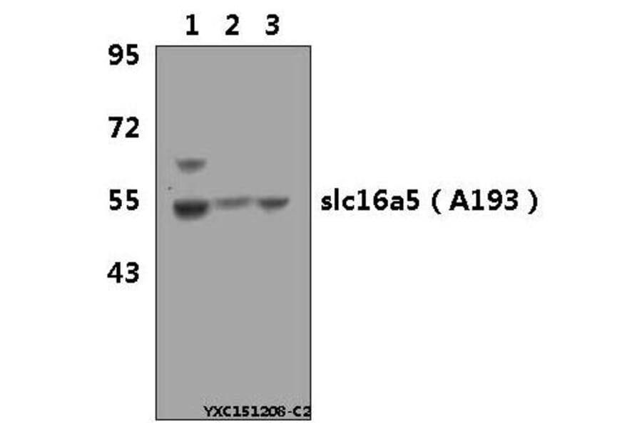 Anti-SLC16A5 (A193) Antibody from Bioworld Technology (AP0702) - Antibodies.com