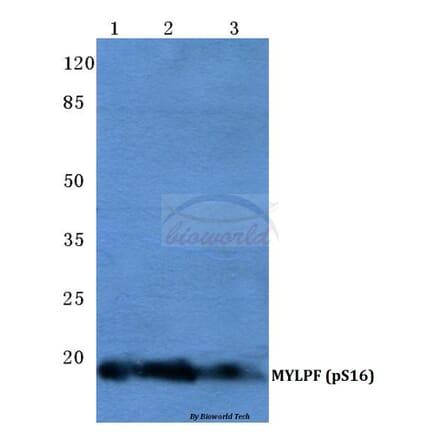 Anti-MYLPF (phospho-S16) Antibody from Bioworld Technology (AP0729) - Antibodies.com