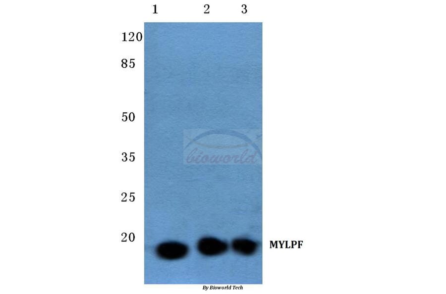 Anti-MYLPF (D23) Antibody from Bioworld Technology (AP0730) - Antibodies.com