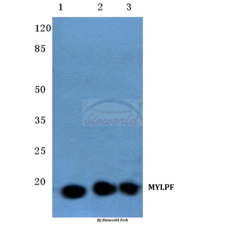 Anti-MYLPF (D23) Antibody from Bioworld Technology (AP0730) - Antibodies.com