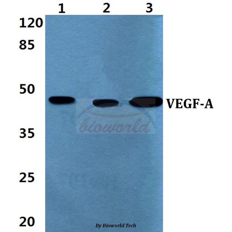 Anti-VEGF-A (L98) Antibody from Bioworld Technology (AP0742) - Antibodies.com