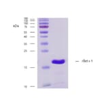 SDS-PAGE - Recombinant Bet v 1 (1.0101) Protein (A242914) - Antibodies.com