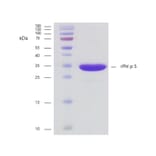 SDS-PAGE - Recombinant Phl p 5 (5.0101) Protein (A242915) - Antibodies.com