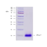 SDS-PAGE - Recombinant Phl p 7 (7.0101) Protein (A242916) - Antibodies.com