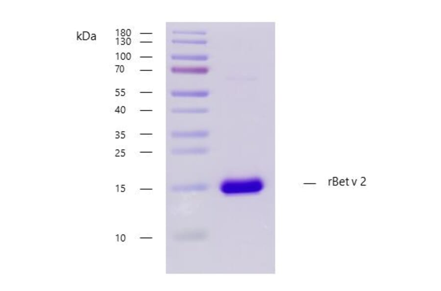 SDS-PAGE - Recombinant Bet v 2 (2.0101) Protein (A242916) - Antibodies.com
