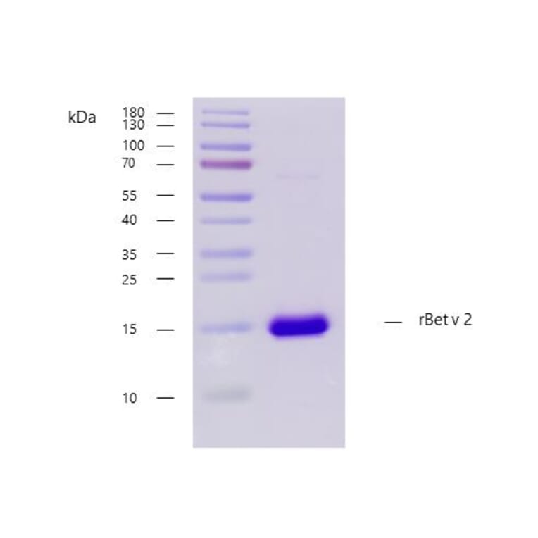 SDS-PAGE - Recombinant Bet v 2 (2.0101) Protein (A242916) - Antibodies.com