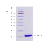 SDS-PAGE - Recombinant Bet v 4 (4.0101) Protein (A242924) - Antibodies.com