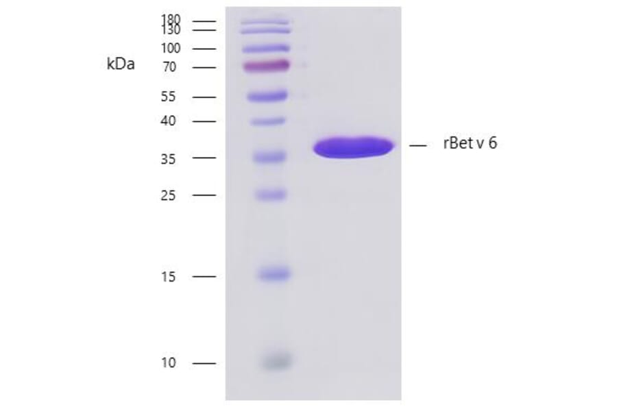 SDS-PAGE - Recombinant Bet v 6 (6.0102) Protein (A242925) - Antibodies.com