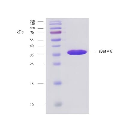 SDS-PAGE - Recombinant Bet v 6 (6.0102) Protein (A242925) - Antibodies.com