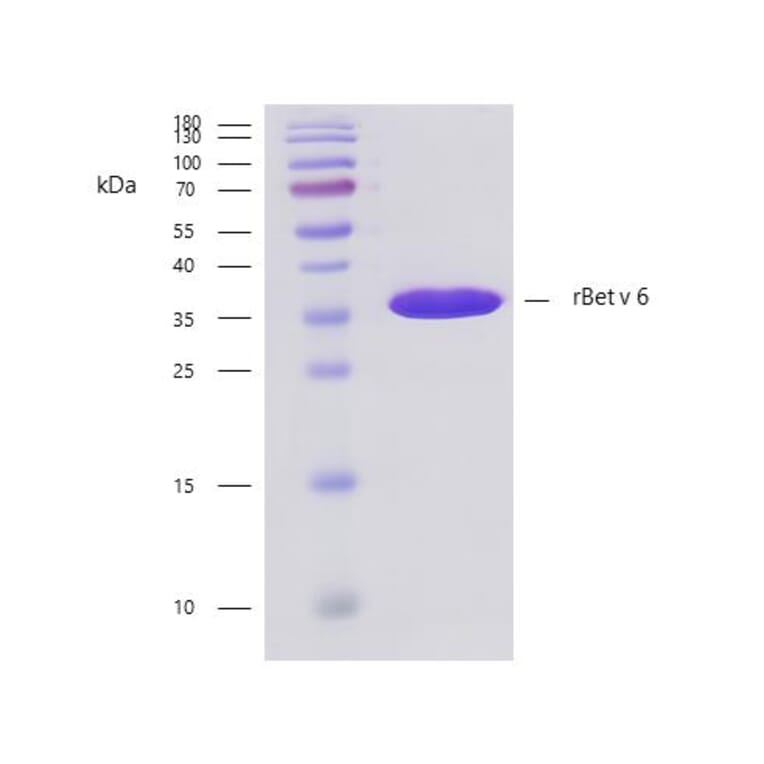 SDS-PAGE - Recombinant Bet v 6 (6.0102) Protein (A242925) - Antibodies.com
