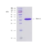 SDS-PAGE - Recombinant Bet v 6 (6.0102) Protein (A242925) - Antibodies.com