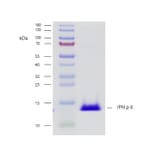 SDS-PAGE - Recombinant Phl p 6 (6.0101) Protein (A242928) - Antibodies.com