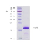 SDS-PAGE - Recombinant Ara h 8 (8.0101) Protein (A242929) - Antibodies.com