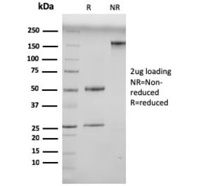 SDS-PAGE - Anti-N Cadherin Antibody [13A9] (A0) - Antibodies.com