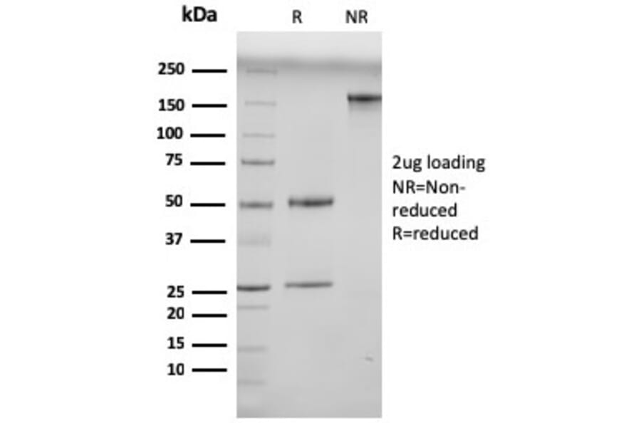 SDS-PAGE - Anti-N Cadherin Antibody [13A9] (A0) - Antibodies.com