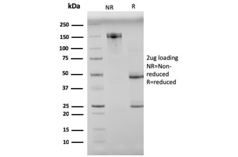 SDS-PAGE - Anti-N Cadherin Antibody [8C11] (A248056) - Antibodies.com