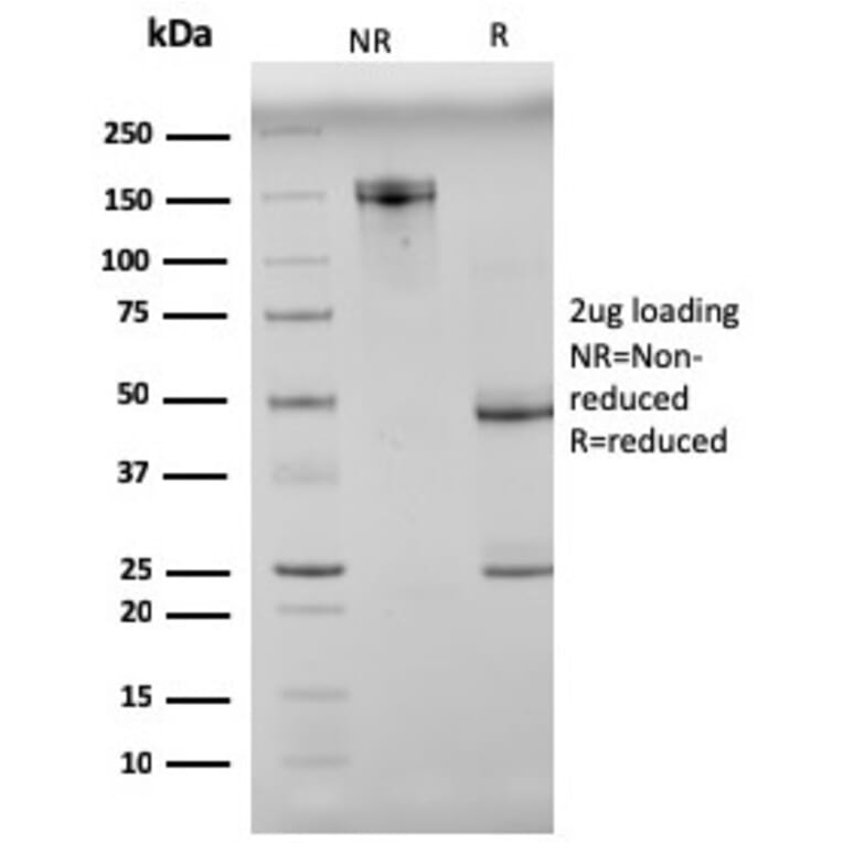 SDS-PAGE - Anti-N Cadherin Antibody [8C11] (A248056) - Antibodies.com
