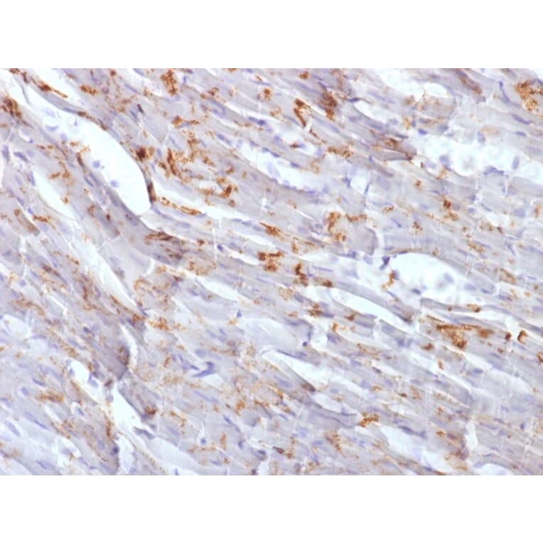 Immunohistochemistry - Anti-N Cadherin Antibody [CDH2/1573] (A248056) - Antibodies.com