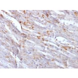 Immunohistochemistry - Anti-N Cadherin Antibody [CDH2/1573] (A248056) - Antibodies.com