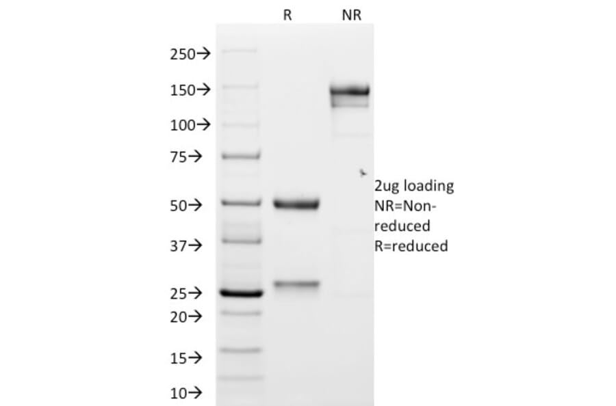 SDS-PAGE - Anti-N Cadherin Antibody [CDH2/1573] (A248057) - Antibodies.com