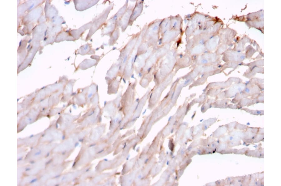 Immunohistochemistry - Anti-N Cadherin Antibody [rCDH2/1426] (A248057) - Antibodies.com