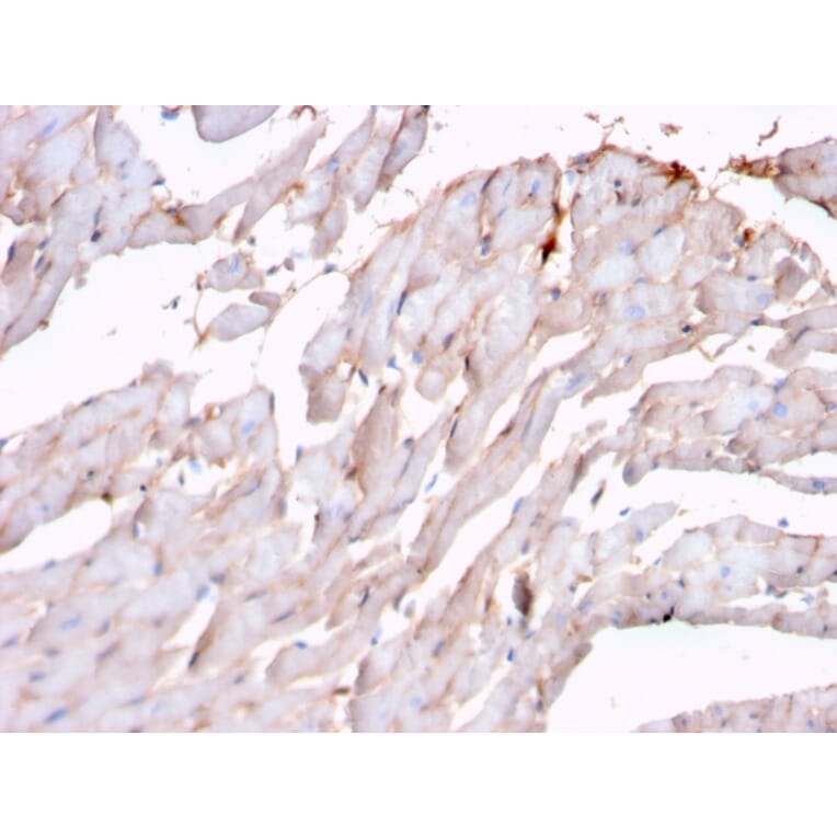 Immunohistochemistry - Anti-N Cadherin Antibody [rCDH2/1426] (A248057) - Antibodies.com