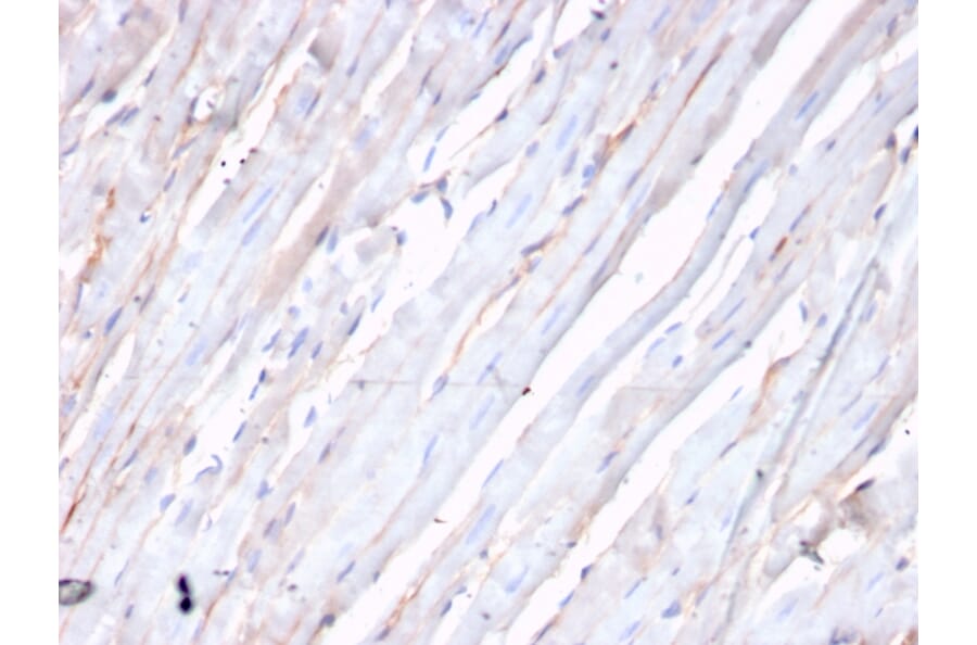 Immunohistochemistry - Anti-N Cadherin Antibody [CDH2/3874R] (A248058) - Antibodies.com
