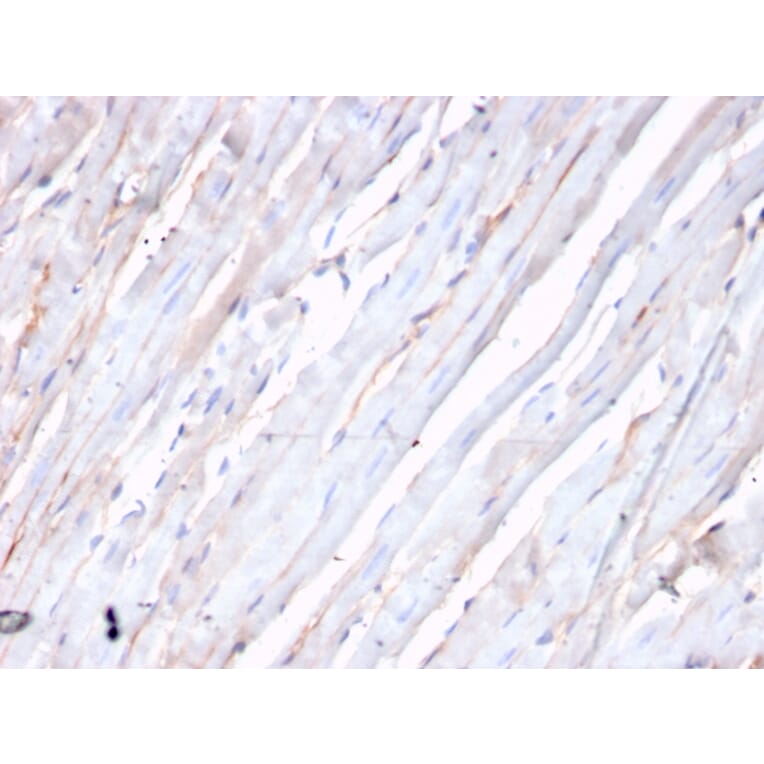 Immunohistochemistry - Anti-N Cadherin Antibody [CDH2/3874R] (A248058) - Antibodies.com