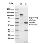 SDS-PAGE - Anti-N Cadherin Antibody [CDH2/3874R] (A248059) - Antibodies.com
