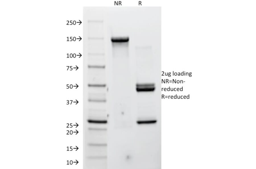 SDS-PAGE - Anti-P Cadherin Antibody [12H6] (A248060) - Antibodies.com