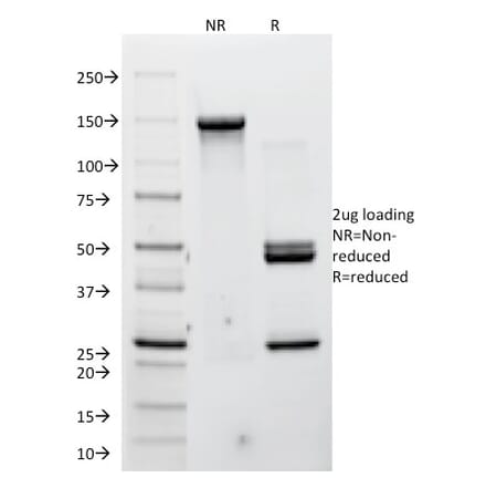 SDS-PAGE - Anti-P Cadherin Antibody [12H6] (A248060) - Antibodies.com