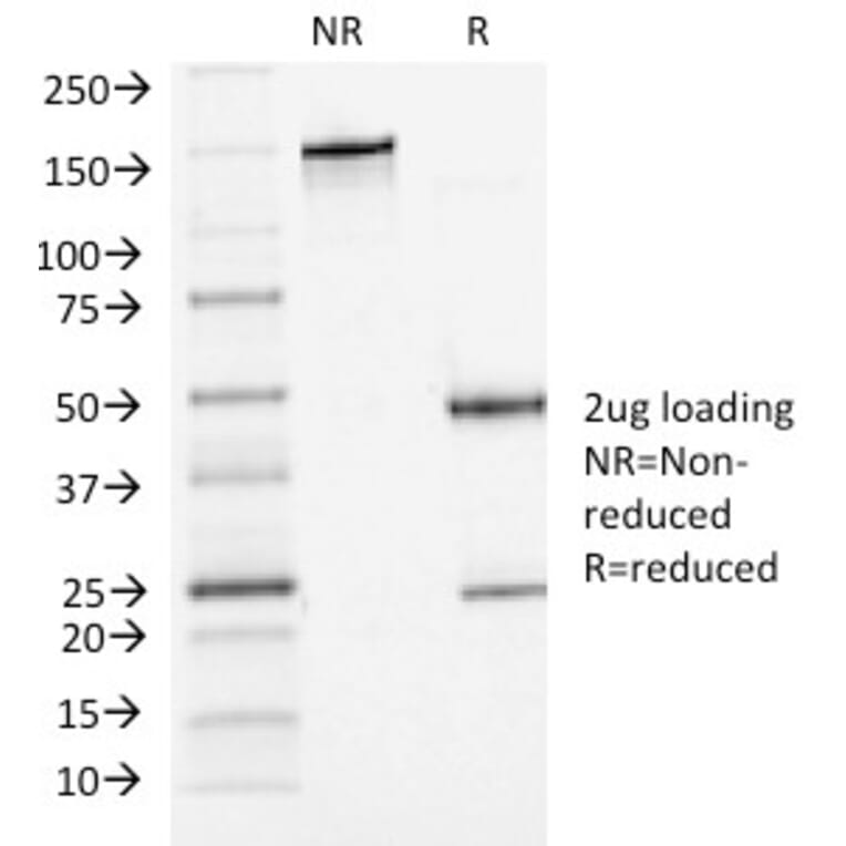 SDS-PAGE - Anti-P Cadherin Antibody [6A9] (A248061) - Antibodies.com