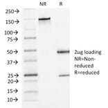 SDS-PAGE - Anti-P Cadherin Antibody [6A9] (A248061) - Antibodies.com