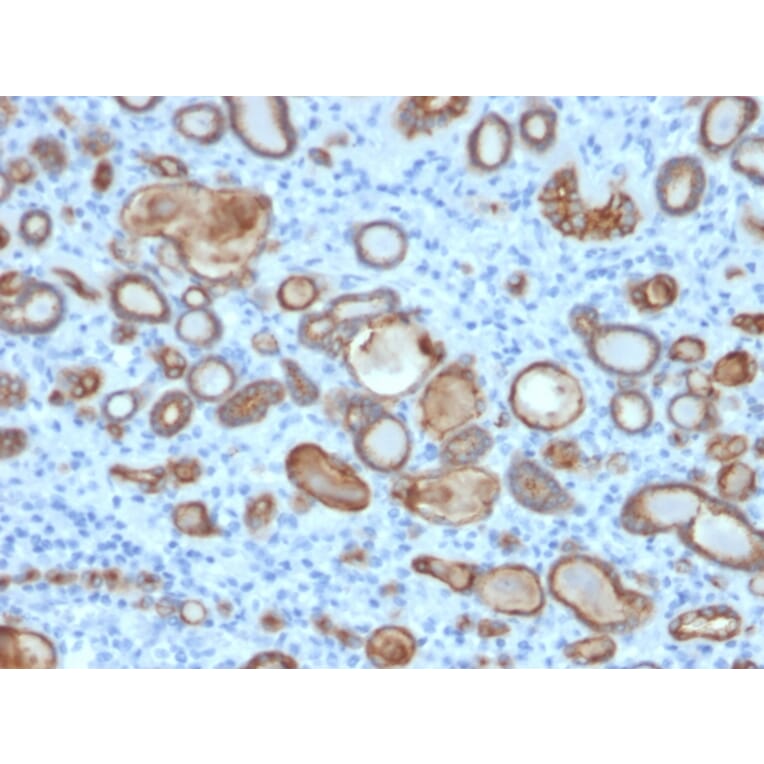 Immunohistochemistry - Anti-Occludin Antibody [OCLN/2181] (A248063) - Antibodies.com
