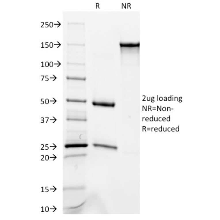 SDS-PAGE - Anti-Occludin Antibody [OCLN/2181] (A248063) - Antibodies.com